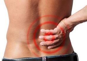 Rückenschmerzen mit lumbaler Osteochondrose
